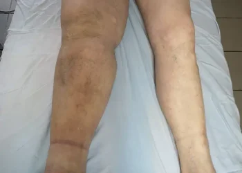 Визуализация на лимфната система